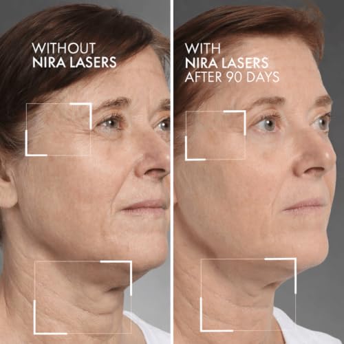 NIRA - FDA Cleared Anti Wrinkle Devices, Face Laser, Collagen Rebuild