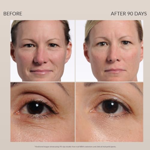 NIRA - FDA Cleared Anti Wrinkle Devices, Face Laser, Collagen Rebuild