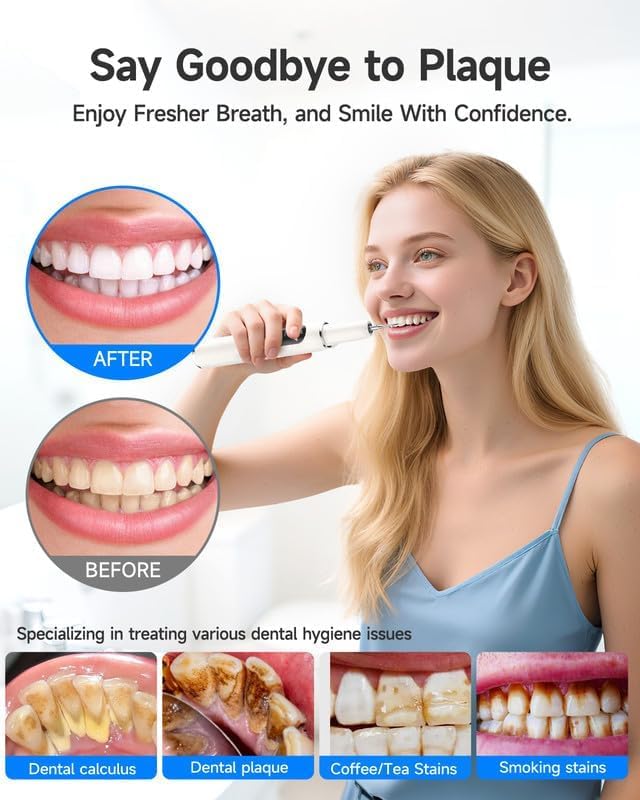 RELACS 7000, Plaque Remover for Teeth, Tartar Remover for Teeth