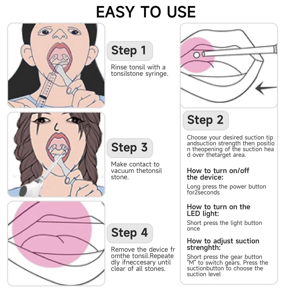 Tonsil Stone Removal Kit with LED Suction Tool