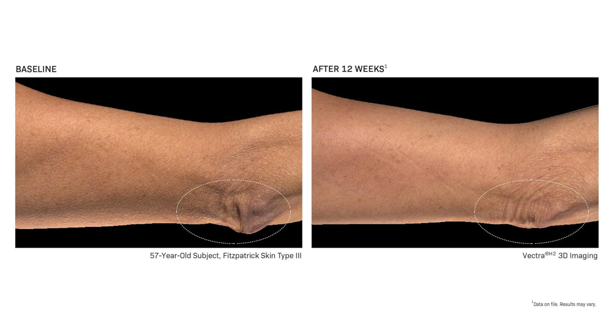 Revision Skincare BodiContour™ Advanced Firming Body Cream