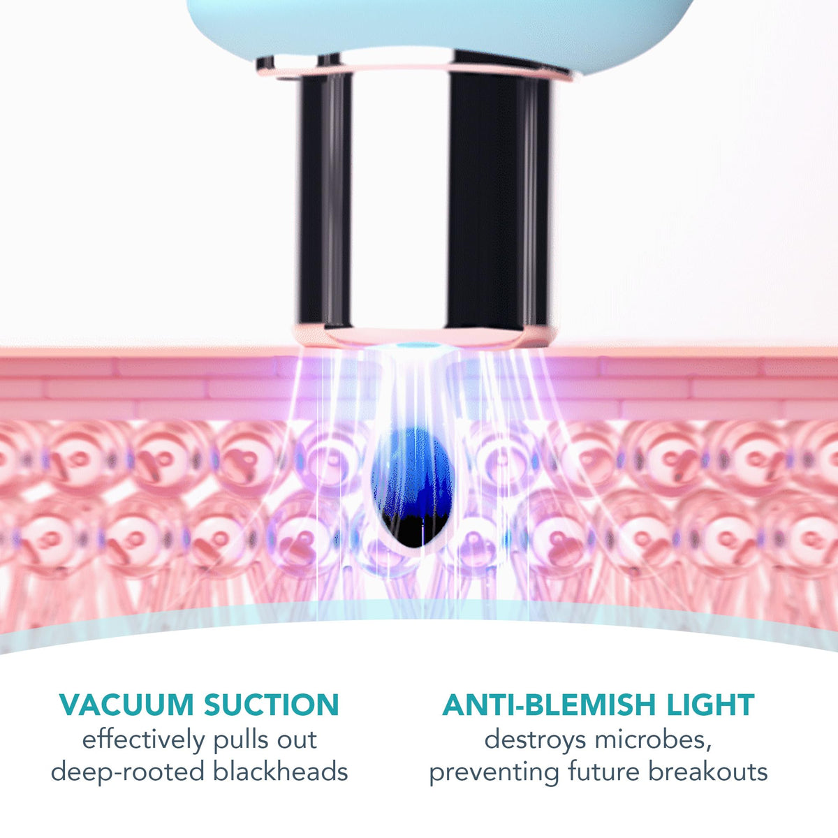 FOREO KIWI derma